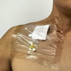 Moisutre Barrier & Sterile Dressing